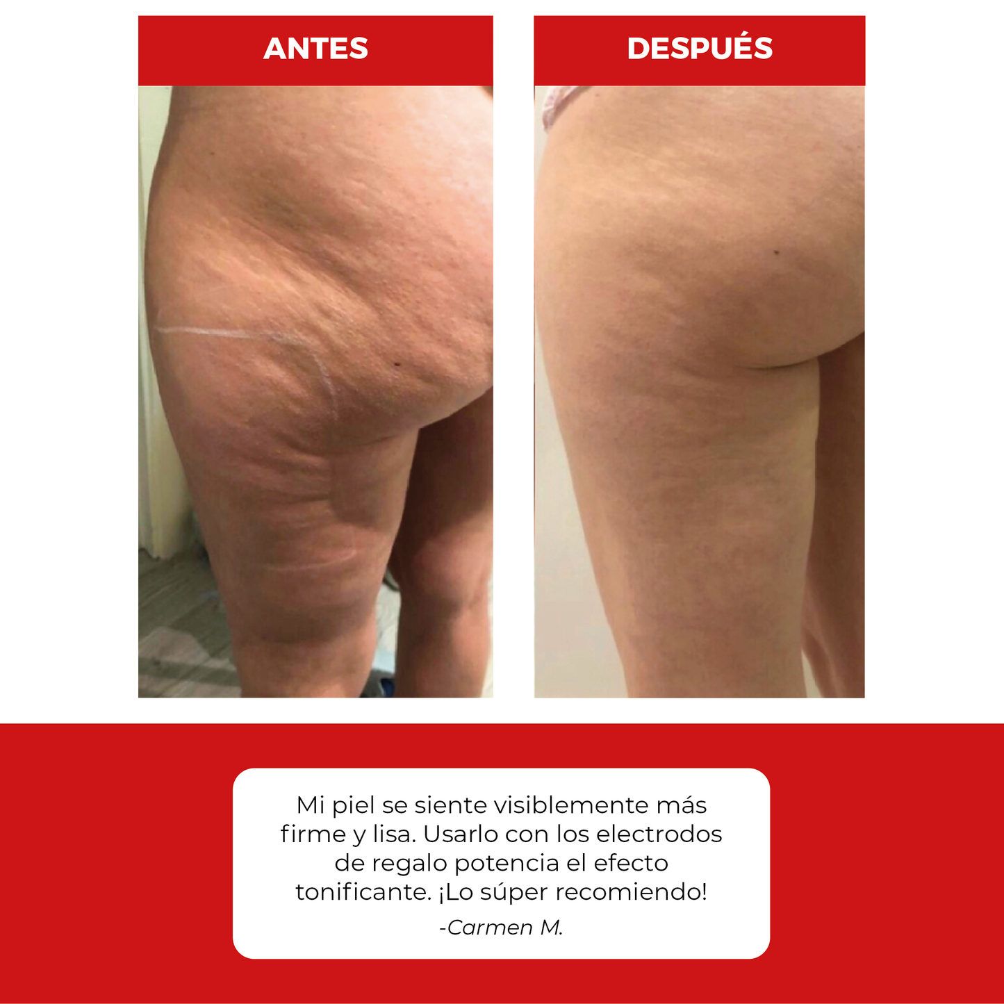 Masajeador Anticelulitis 4 en 1 + Electroestimulador EMS para Glúteos de Regalo